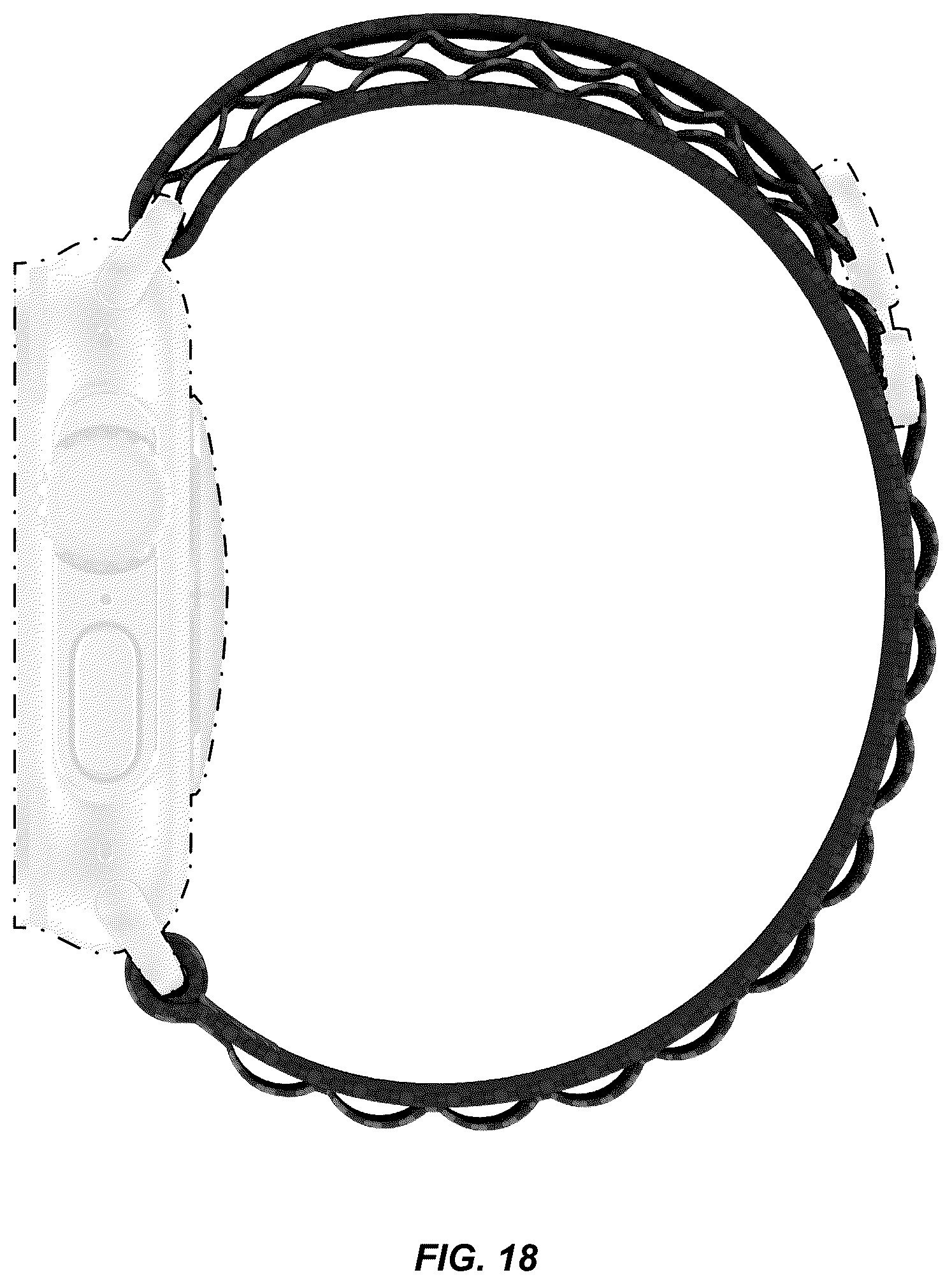 Patent USD1125156 Figure 18 – Wearable device